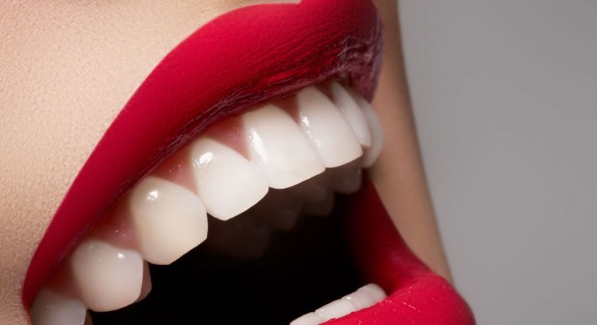Время улыбаться чаще! Профессиональная чистка зубов ультразвуком + отбеливание от стоматологической клиники «Ru.Dent»
