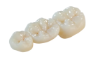 Коронка зуба из оксида циркония (без слепков, фиксации, ретракции)