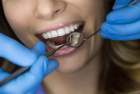 Объемное эстетическое восстановление  жевательного зуба с анестезией без штифта