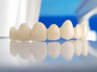 Восстановление зуба коронкой из оксида циркония