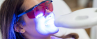 Профессиональное ламповое отбеливание зубов фотоактивированным методом Zoom 4