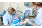 Восстановление зуба (Стекловолоконный штифт)