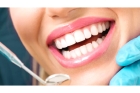 Реставрация передних зубов 
