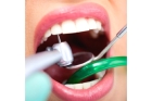 Лечение зубов  в рассрочку