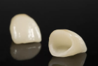 Коронка керамическая на зуб