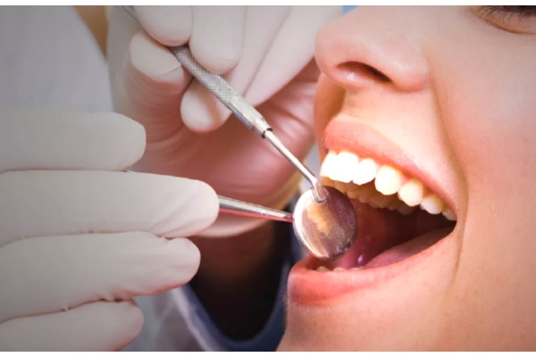 Реставрация передних зубов 
