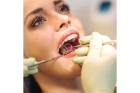 Лечение периодонтита постоянных зубов