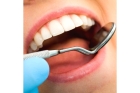 Лечение периодонтита временных зубов