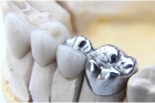 Титановые коронки на зубы