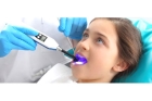 Удаление верхних молочных зубов