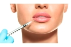 Увеличение губ препаратом PRINCESS FILLER