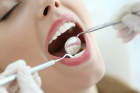 Лечение периодонтита одноканального зуба в одно посещение