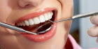 Лечение периодонтита двухканального  зуба в два-три посещения