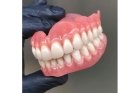 Съемный протез при отсутствии зубов